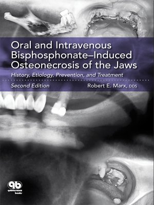 cover image of Oral and Intravenous Bisphosphonate–Induced Osteonecrosis of the Jaws